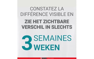 Purina ONE | Kattenvoeding | Sterilised | Pâté | Zalm & Kalkoen 