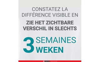 Purina ONE | Kattenvoeding | Sterilised | Pâté | Zalm & Kalkoen 